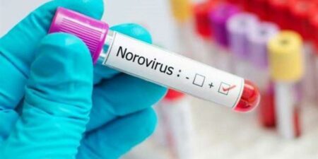 Norovirus نوروفيروس